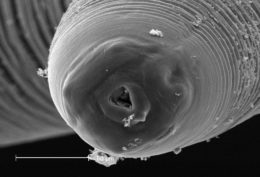 Fig. 2. Escaneado de microscopio electrónico de un nematodo Anisakis. Fuente: Wikkimedia Commons. Fig. 2. Escaneado de microscopio electrónico de un nematodo Anisakis. Fuente: Wikkimedia Commons.