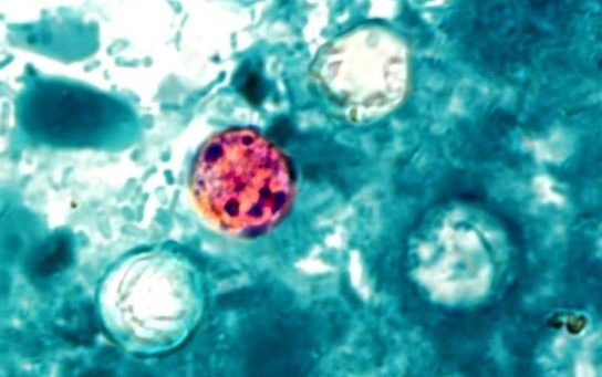 Fig. 1. Imagen de microscopio de oquistes del parásito Cyclospora cayetanensis. Imagen: Center for Disease Control and Prevention (CDC). Fuente: Wikkimedia Commons. Fig. 1. Imagen de microscopio de oquistes del parásito Cyclospora cayetanensis. Imagen: Center for Disease Control and Prevention (CDC). Fuente: Wikkimedia Commons.
